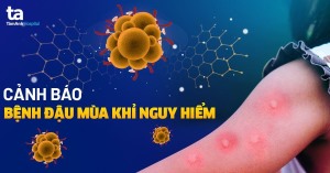 Người dân cần chủ động phòng, chống bệnh đậu mùa khỉ