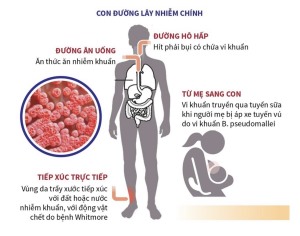 Chủ động phòng tránh bệnh Whitmore trên địa bàn thành phố Hạ Long